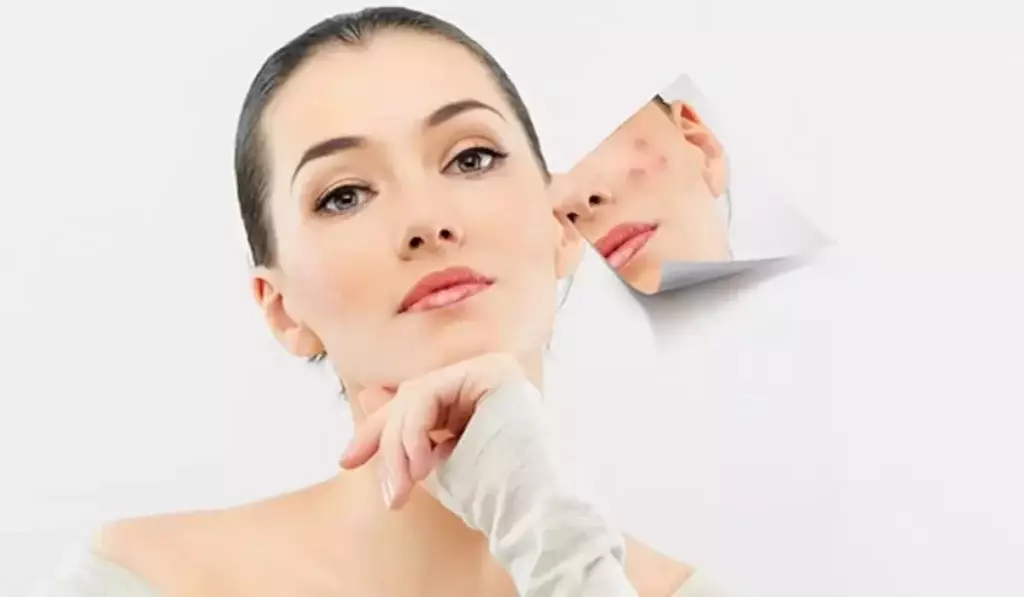 گالری تصاویر